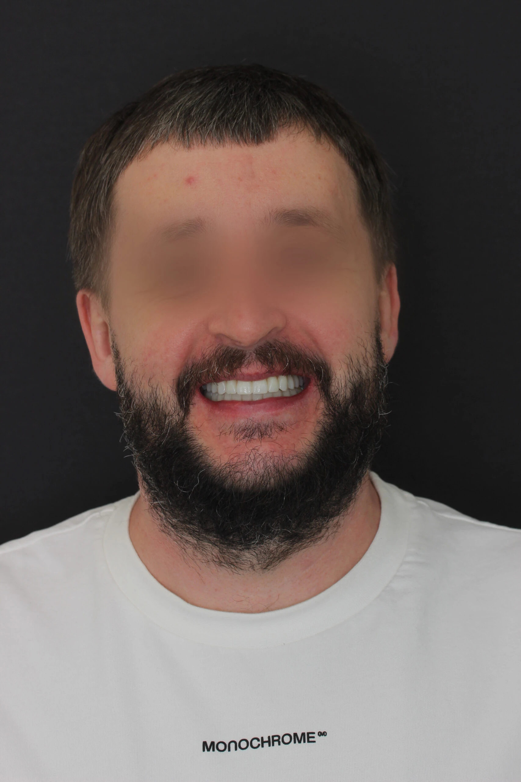 фото пациента